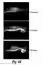 Fig. 72 - CNS delivery of therapeutic agents