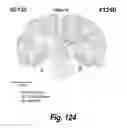 Fig. 92 - CNS delivery of therapeutic agents