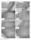 Fig. 01 - Composition containing arazyme for the prevention and treatment of cancer