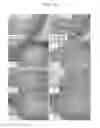 Fig. 04 - Composition containing arazyme for the prevention and treatment of cancer