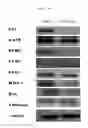 Fig. 11 - Composition containing arazyme for the prevention and treatment of cancer