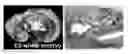 Fig. 01 - Compositions and methods for modulating vascular development