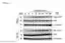 Fig. 02 - Methods used in identifying glioblastoma