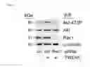 Fig. 04 - Methods used in identifying glioblastoma
