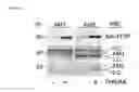 Fig. 12 - Methods used in identifying glioblastoma