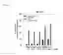 Fig. 16 - Methods used in identifying glioblastoma