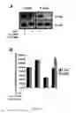 Fig. 04 - Modulating PDX-1 with PCIF1, methods and uses thereof