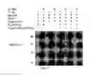 Fig. 16 - Modulating PDX-1 with PCIF1, methods and uses thereof