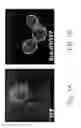 Fig. 02 - YEAST ECTOPICALLY EXPRESSING ABNORMALLY PROCESSED PROTEINS AND USES THEREFOR