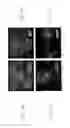 Fig. 03 - YEAST ECTOPICALLY EXPRESSING ABNORMALLY PROCESSED PROTEINS AND USES THEREFOR