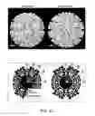 Fig. 06 - Virus-like particles (VLPs) prepared from chikungunya virus structural proteins