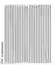 Fig. 48 - Virus-like particles (VLPs) prepared from chikungunya virus structural proteins