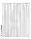Fig. 63 - Virus-like particles (VLPs) prepared from chikungunya virus structural proteins