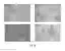 Fig. 07 - Dermal micro-organs, methods and apparatuses for producing and using the same