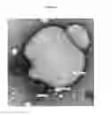 Fig. 04 - NANOEMULSION VACCINES