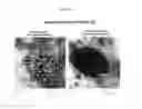 Fig. 17 - NANOEMULSION VACCINES