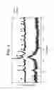 Fig. 05 - CERAMIC/STRUCTURAL PROTEIN COMPOSITES AND METHOD OF PREPARATION THEREOF