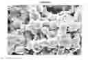 Fig. 07 - Injectable biomaterials