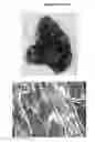 Fig. 14 - Injectable biomaterials