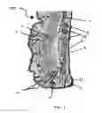 Fig. 02 - NEW METHODS OF TREATING DRY EYE SYNDROME