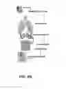 Fig. 03 - Unit doses, aerosols, kits, and methods for treating heart conditions by pulmonary administration