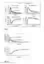 Fig. 05 - Unit doses, aerosols, kits, and methods for treating heart conditions by pulmonary administration