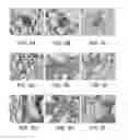 Fig. 04 - Use of A2B Adenosine Receptor Antagonists for Treating Pulmonary Hypertension