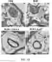 Fig. 15 - Use of A2B Adenosine Receptor Antagonists for Treating Pulmonary Hypertension