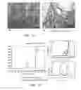 Fig. 09 - METHOD FOR DEPOSITING NANOPARTICLES ON A SUPPORT