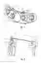 Fig. 03 - Casing molded with attached pipes