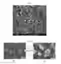 Fig. 03 - Anode-supported solid oxide fuel cell comprising a nanoporous layer having a pore gradient structure, and a production method therefor
