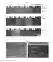 Fig. 04 - Anode-supported solid oxide fuel cell comprising a nanoporous layer having a pore gradient structure, and a production method therefor