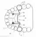 Fig. 01 - Orthodontic corrective appliance, especially for correcting malpositioned molars