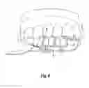 Fig. 07 - DEVICE FOR OBSERVATION OF THE ORAL CAVITY
