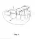 Fig. 12 - DEVICE FOR OBSERVATION OF THE ORAL CAVITY