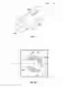 Fig. 06 - Air water vacuum syringe and method of use