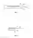 Fig. 10 - Air water vacuum syringe and method of use