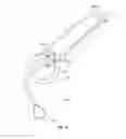Fig. 11 - Air water vacuum syringe and method of use