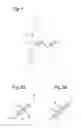 Fig. 04 - Occlusal adjustment system