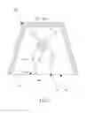 Fig. 04 - Detachment-prevented removable double-crown prosthetic appliance