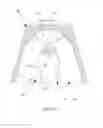 Fig. 05 - Detachment-prevented removable double-crown prosthetic appliance