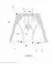 Fig. 08 - Detachment-prevented removable double-crown prosthetic appliance
