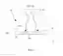 Fig. 10 - Detachment-prevented removable double-crown prosthetic appliance