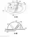Fig. 09 - Methods of simulating combat