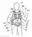Fig. 01 - Wearable partial task surgical simulator