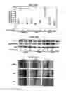 Fig. 43 - CANCER BIOMARKERS AND METHODS OF USE THEREOF