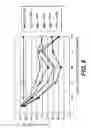 Fig. 10 - Magnetic lysis method and device