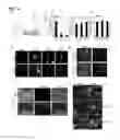 Fig. 44 - IDENTIFICATION OF NEUROPROTECTIVE AGENTS USING PRO-INFLAMMATORY HUMAN GLIAL CELLS