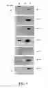 Fig. 02 - Dissolved protein arthritis markers