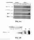 Fig. 07 - Dissolved protein arthritis markers